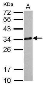 Clathrin Light Chain A Antibody in Western Blot (WB)