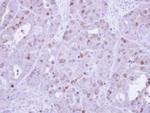 Cyclin A2 Antibody in Immunohistochemistry (Paraffin) (IHC (P))