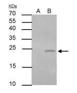 PUMA alpha Antibody in Immunoprecipitation (IP)