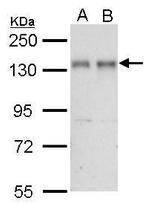 NFATC2 Antibody in Western Blot (WB)