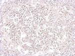 Porcine Circovirus Type 2 Capsid Antibody in Immunohistochemistry (Paraffin) (IHC (P))