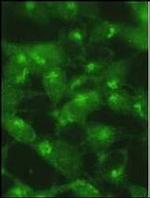 LC3A (Cleaved Gly120) Antibody in Immunocytochemistry (ICC/IF)