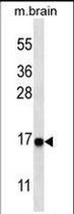 LC3A (Cleaved Gly120) Antibody in Western Blot (WB)