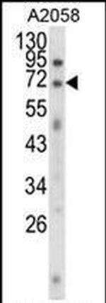 EWSR1 Antibody in Western Blot (WB)