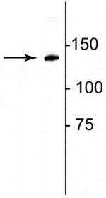 Procollagen I C-Peptide Antibody in Western Blot (WB)