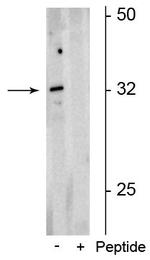 Phospho-OLIG2 (Ser10, Ser13, Ser14) Antibody in Western Blot (WB)