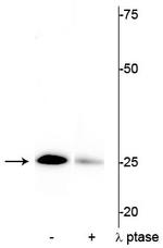 Phospho-Cardiac Troponin I (Ser43) Antibody in Western Blot (WB)