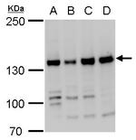 RFC1 Antibody in Western Blot (WB)