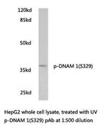 Phospho-CD226 (Ser329) Antibody in Western Blot (WB)