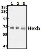 HEXB Antibody in Western Blot (WB)