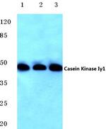 CK1 gamma-1 Antibody in Western Blot (WB)