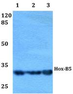 HOXB5 Antibody in Western Blot (WB)