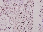 MSK1 Antibody in Immunohistochemistry (Paraffin) (IHC (P))