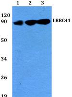 LRRC41 Antibody in Western Blot (WB)