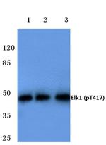 Phospho-ELK1 (Thr417) Antibody in Western Blot (WB)