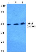 Phospho-IkB beta (Thr19) Antibody in Western Blot (WB)