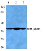 Phospho-NPM1 (Thr234) Antibody in Western Blot (WB)