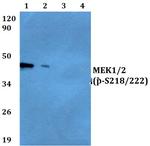 Phospho-MEK1/MEK2 (Ser218, Ser222) Antibody in Western Blot (WB)