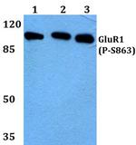 Phospho-GluR1 (Ser863) Antibody in Western Blot (WB)