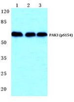 Phospho-PAK3 (Ser154) Antibody in Western Blot (WB)