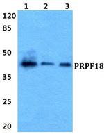 PRPF18 Antibody in Western Blot (WB)