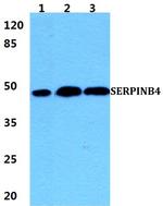 SERPINB4 Antibody in Western Blot (WB)