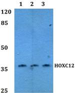 HOXC12 Antibody in Western Blot (WB)
