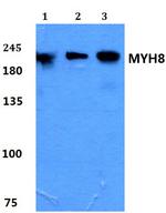MYH8 Antibody in Western Blot (WB)