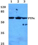 PTPRK Antibody in Western Blot (WB)