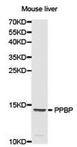 PPBP Antibody in Western Blot (WB)