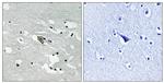 Phospho-VEGF Receptor 1 (Tyr1048) Antibody in Immunohistochemistry (Paraffin) (IHC (P))