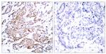 Phospho-c-Myc (Thr58) Antibody in Immunohistochemistry (Paraffin) (IHC (P))