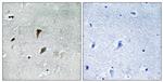Phospho-MEK3 (Thr222) Antibody in Immunohistochemistry (Paraffin) (IHC (P))