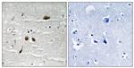 Phospho-MDC1 (Ser513) Antibody in Immunohistochemistry (Paraffin) (IHC (P))