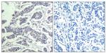 Phospho-AKT Pan (Tyr315, Tyr316, Tyr312) Antibody in Immunohistochemistry (Paraffin) (IHC (P))