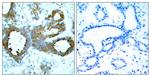 Phospho-PAK1/2/3 (Thr423, Thr402, Thr421) Antibody in Immunohistochemistry (Paraffin) (IHC (P))