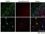 ZNRF1 Antibody in Immunohistochemistry (Paraffin) (IHC (P))
