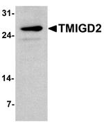 TMIGD2 Antibody in Western Blot (WB)