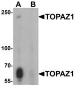 TOPAZ1 Antibody in Western Blot (WB)