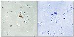 Phospho-TrkA (Tyr701) Antibody in Immunohistochemistry (Paraffin) (IHC (P))