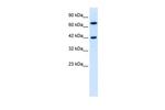 TOX2 Antibody in Western Blot (WB)