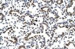 ZNF385A Antibody in Immunohistochemistry (IHC)
