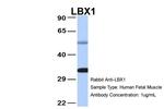 LBX1 Antibody in Western Blot (WB)