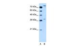 NFE2L3 Antibody in Western Blot (WB)