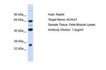 KLHL41 Antibody in Western Blot (WB)