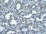 ZMYND11 Antibody in Immunohistochemistry (Paraffin) (IHC (P))