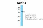 KCNN4 Antibody in Western Blot (WB)