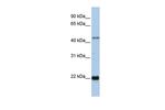 ZNF581 Antibody in Western Blot (WB)