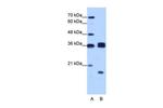 hnRNP H3 Antibody in Western Blot (WB)