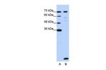 LSM2 Antibody in Western Blot (WB)